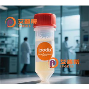 OSM抗体,Rabbit Polyclonal OSM Antibody