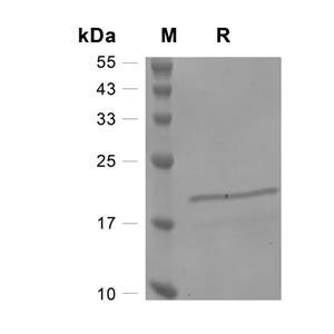 重组人成纤维细胞生长因子4,Recombinant Human FGF-4