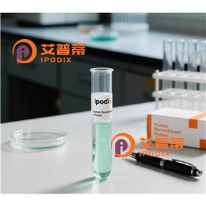 EIF2AK3抗体,Rabbit Polyclonal EIF2AK3 Antibody