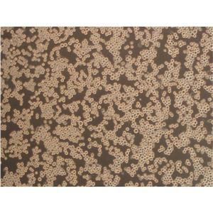 OCUT-2C Cells人甲状腺癌细胞专业复苏|STR图谱