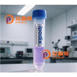 IDH3B抗体,Rabbit Polyclonal IDH3B Antibody