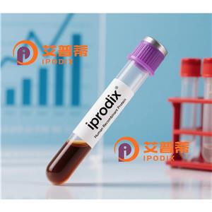 RPN1抗体,Rabbit Polyclonal RPN1 Antibody