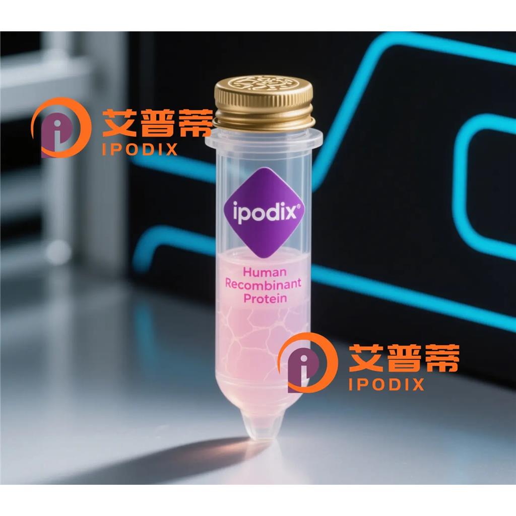 FGFR1OP抗体,Rabbit Polyclonal FGFR1OP Antibody