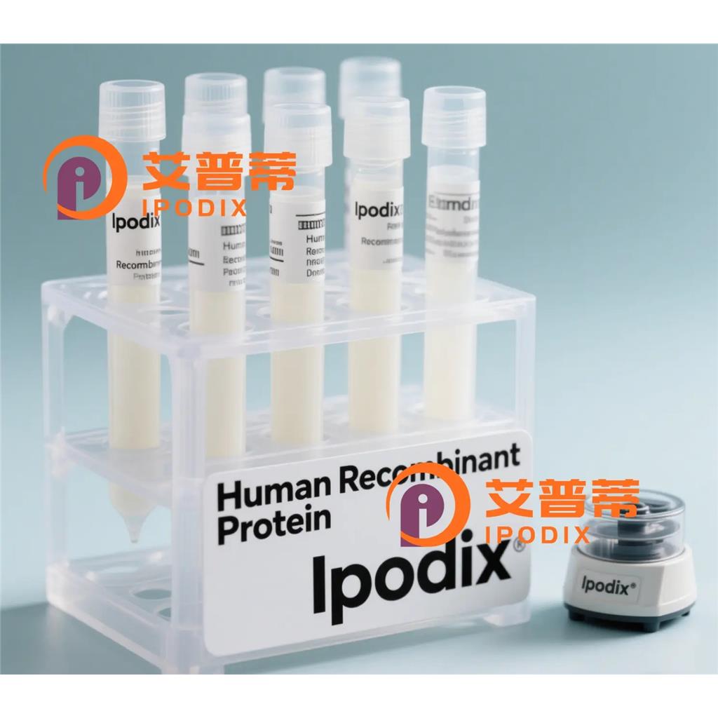 SPOCK3抗体,Rabbit Polyclonal SPOCK3 Antibody