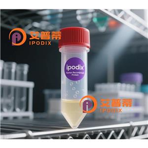 CCN1抗体,Rabbit Polyclonal CCN1 Antibody