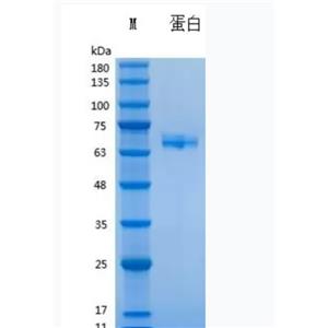 Recombinant Human IL-23重組人白介素-23