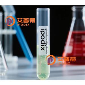 CALCOCO1抗体,Rabbit Polyclonal CALCOCO1 Antibody