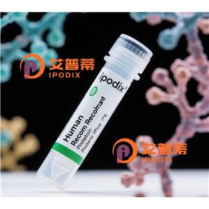 CALCOCO1抗体,Rabbit Polyclonal CALCOCO1 Antibody