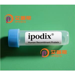 IL1B抗体,Mouse Monoclonal IL1B Antibody