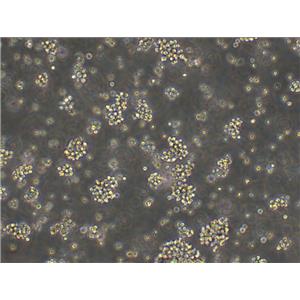 H22 Cells小鼠肝癌细胞低代次保种|STR图谱,H22 Cells