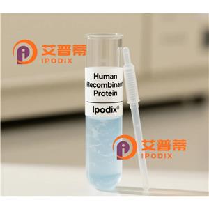 ANTXR1抗体,Rabbit Polyclonal ANTXR1 Antibody