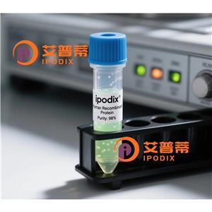 CAP2抗体,Rabbit Polyclonal CAP2 Antibody