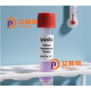 SERPINB6抗體,Rabbit Polyclonal SERPINB6 Antibody