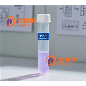 TMPRSS5抗体,Rabbit Polyclonal TMPRSS5 Antibody