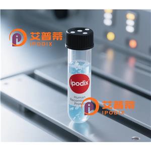 TBL1Y抗体,Rabbit Polyclonal TBL1Y Antibody