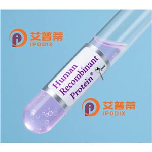 WDR77抗体,Rabbit Polyclonal WDR77 Antibody