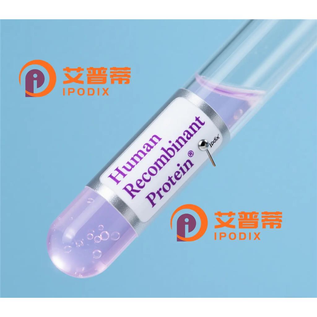 UBASH3A抗体,Rabbit Polyclonal UBASH3A Antibody