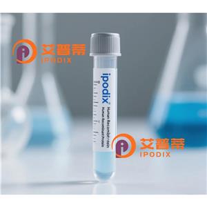 MKS1抗体,Rabbit Polyclonal MKS1 Antibody