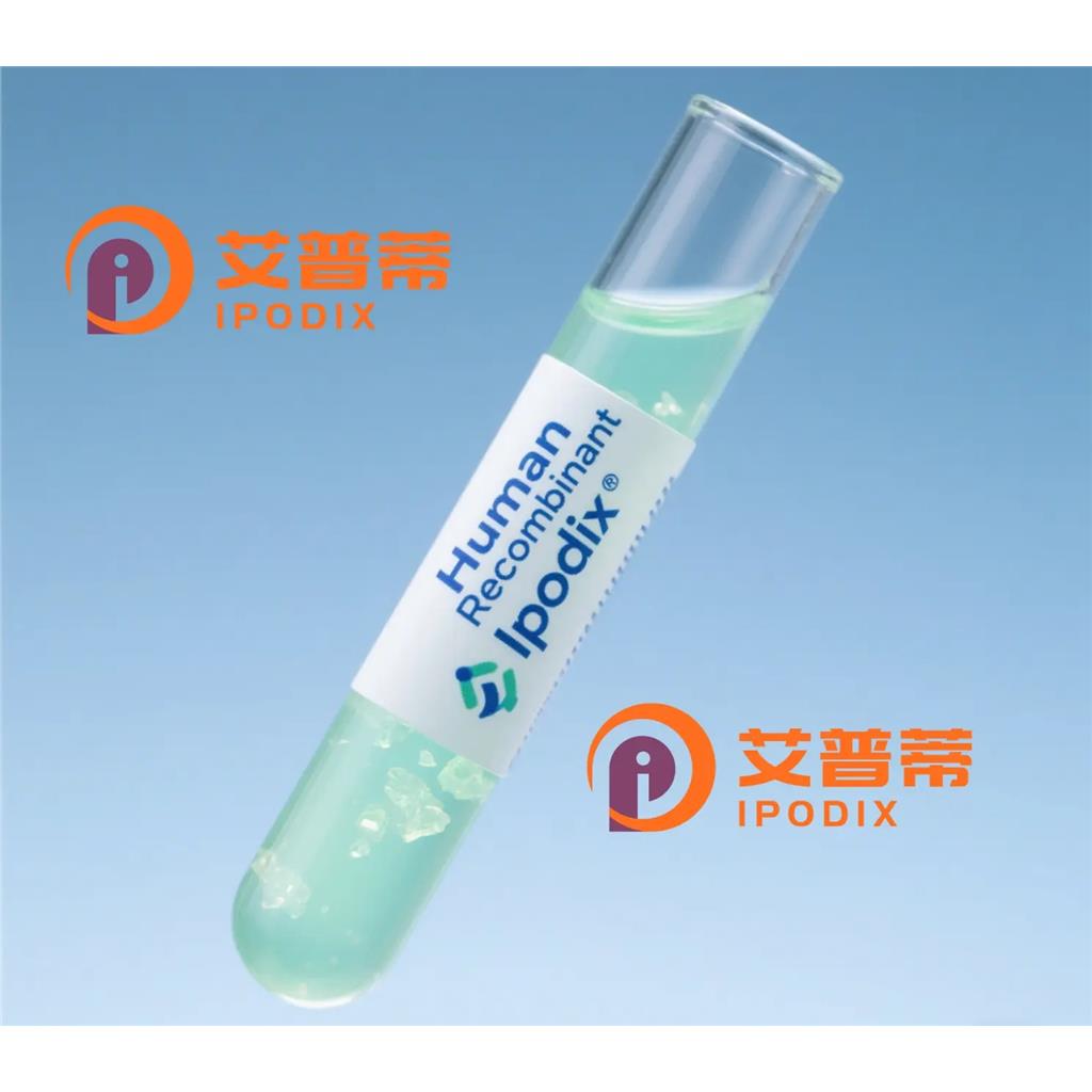 GNS抗體,Rabbit Polyclonal GNS Antibody