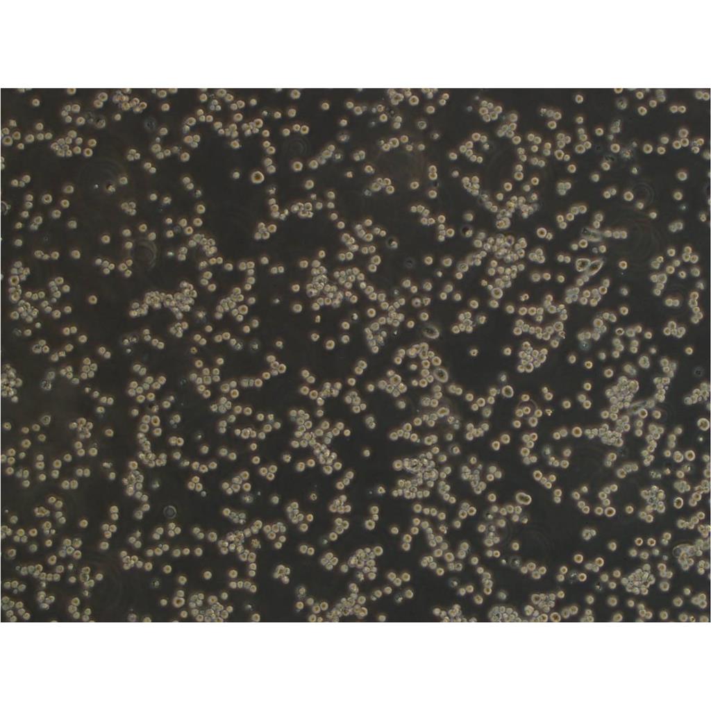 SW579 Cells人甲状腺鳞癌细胞低代次保种|STR图谱,SW579 Cells