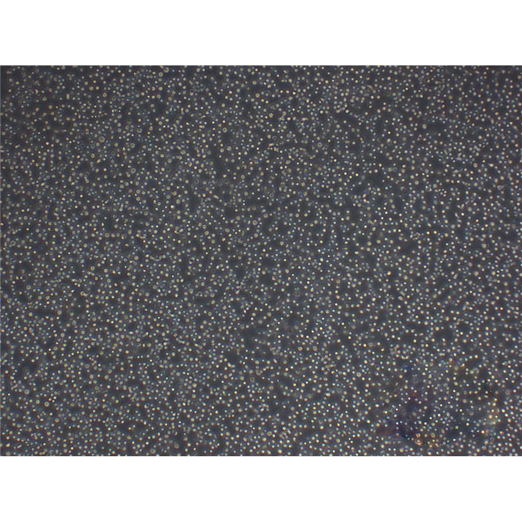 NCI-H292 Cells人肺癌細胞低代次保種|STR圖譜,NCI-H292 Cells