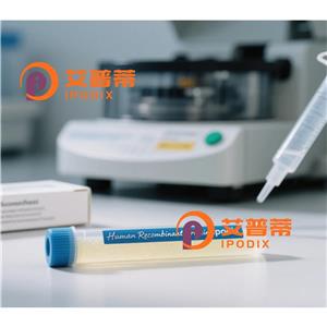 EXOG抗体,Rabbit Polyclonal EXOG Antibody