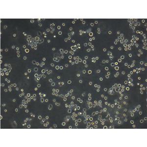 NCI-H522 Cells人非小细胞肺癌细胞低代次保种|STR图谱