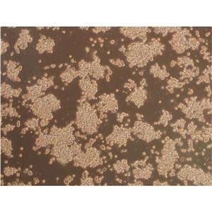 HTR-8/SVneo Cells人絨毛膜滋養(yǎng)層細(xì)胞低代次保種|STR圖譜