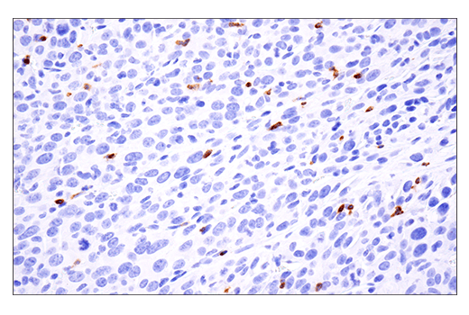 线粒体融合蛋白-2 (D2D10) 兔单克隆抗体,Mitofusin-2 (D2D10) Rabbit mAb