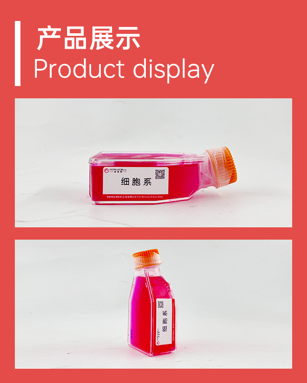 GBC-SD-LUC（人胆囊癌细胞-荧光素酶标记）,GBC-SD-LUC