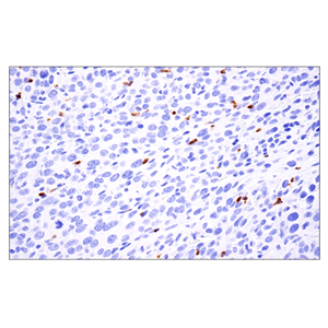 线粒体融合蛋白-2 (D2D10) 兔单克隆抗体,Mitofusin-2 (D2D10) Rabbit mAb
