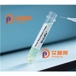 ADAM11抗體,Rabbit Polyclonal ADAM11 Antibody