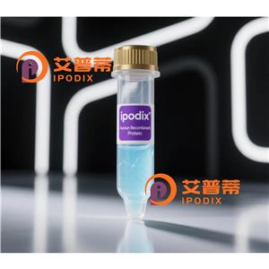 GPT抗体,Rabbit Polyclonal GPT Antibody