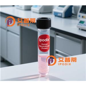 GPD2抗体,Rabbit Polyclonal GPD2 Antibody