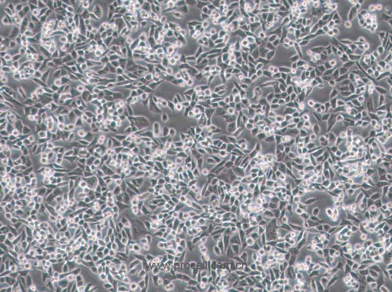 4T1(小鼠乳腺癌细胞) (STR鉴定正确)CL-0007,4T1 Cells Line;4T1-A