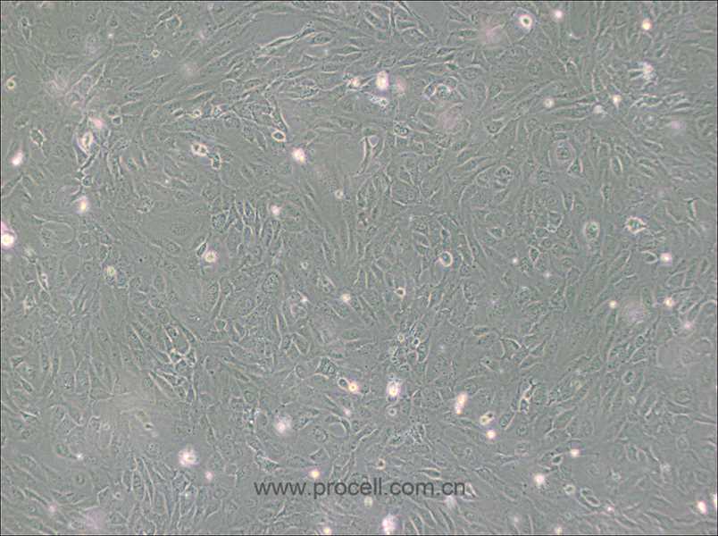 PUMC-HUVEC-T1细胞 (SV40T转化人脐静脉内皮细胞) (STR鉴定正确)CL-0675,PUMC-HUVEC-T1 Cells Line;PUMC-HUVEC-T1