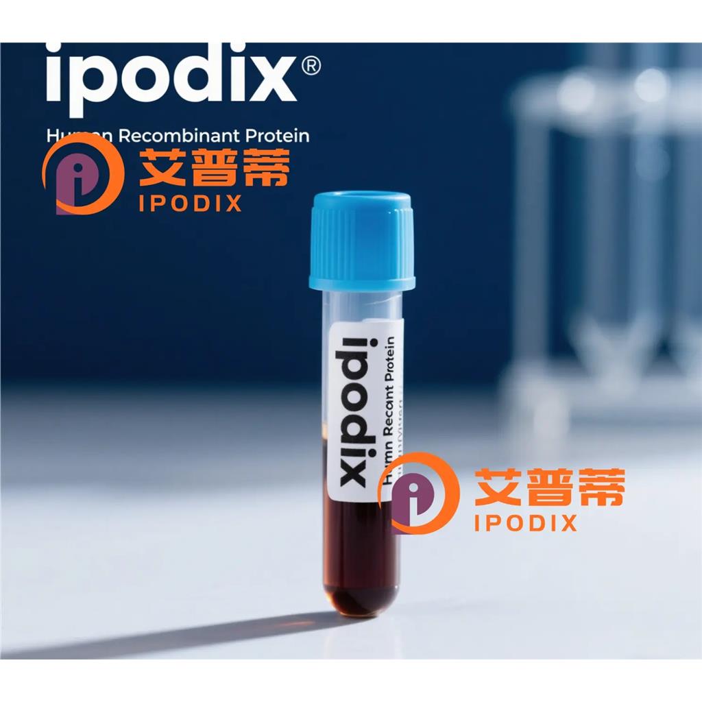 CDK20抗体,Rabbit Polyclonal CDK20 Antibody