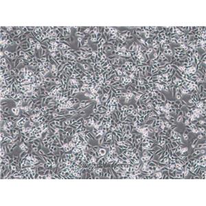 4T1(小鼠乳腺癌细胞) (STR鉴定正确)CL-0007,4T1 Cells Line;4T1-A