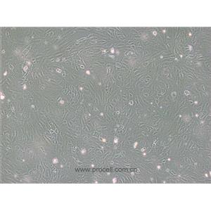 PUMC-HUVEC-T1细胞 (SV40T转化人脐静脉内皮细胞) (STR鉴定正确)CL-0675