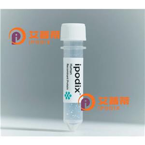 WRNIP1抗体,Rabbit Polyclonal WRNIP1 Antibody