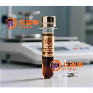 VCX抗体,Rabbit Polyclonal VCX Antibody