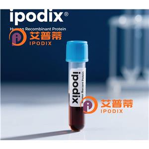 CDK20抗体,Rabbit Polyclonal CDK20 Antibody