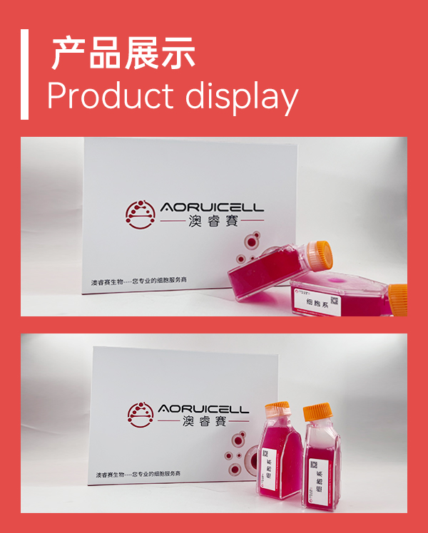 Sf21（昆虫卵巢细胞）,Sf21