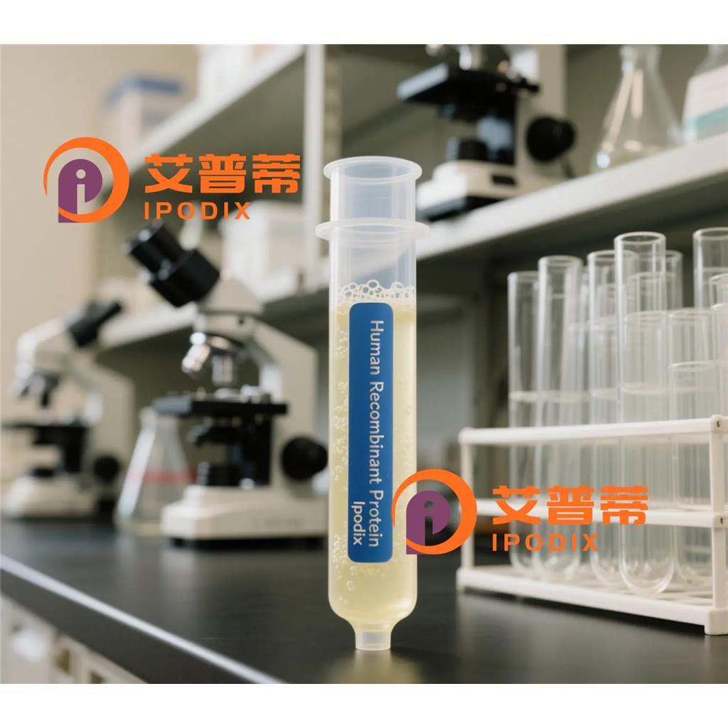 ETV1抗体,Rabbit Polyclonal ETV1 Antibody