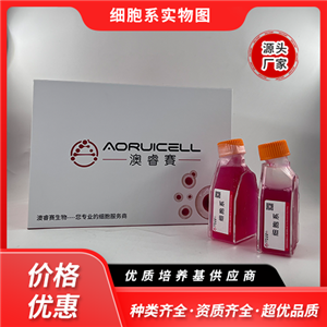 OVISE（人卵巢癌細(xì)胞）