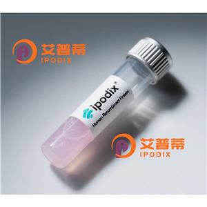 PSIP1/LEDGF抗体,Rabbit Monoclonal PSIP1/LEDGF Antibody