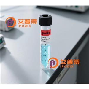 Citratesynthetase抗体,Rabbit Monoclonal Citratesynthetase Antibody