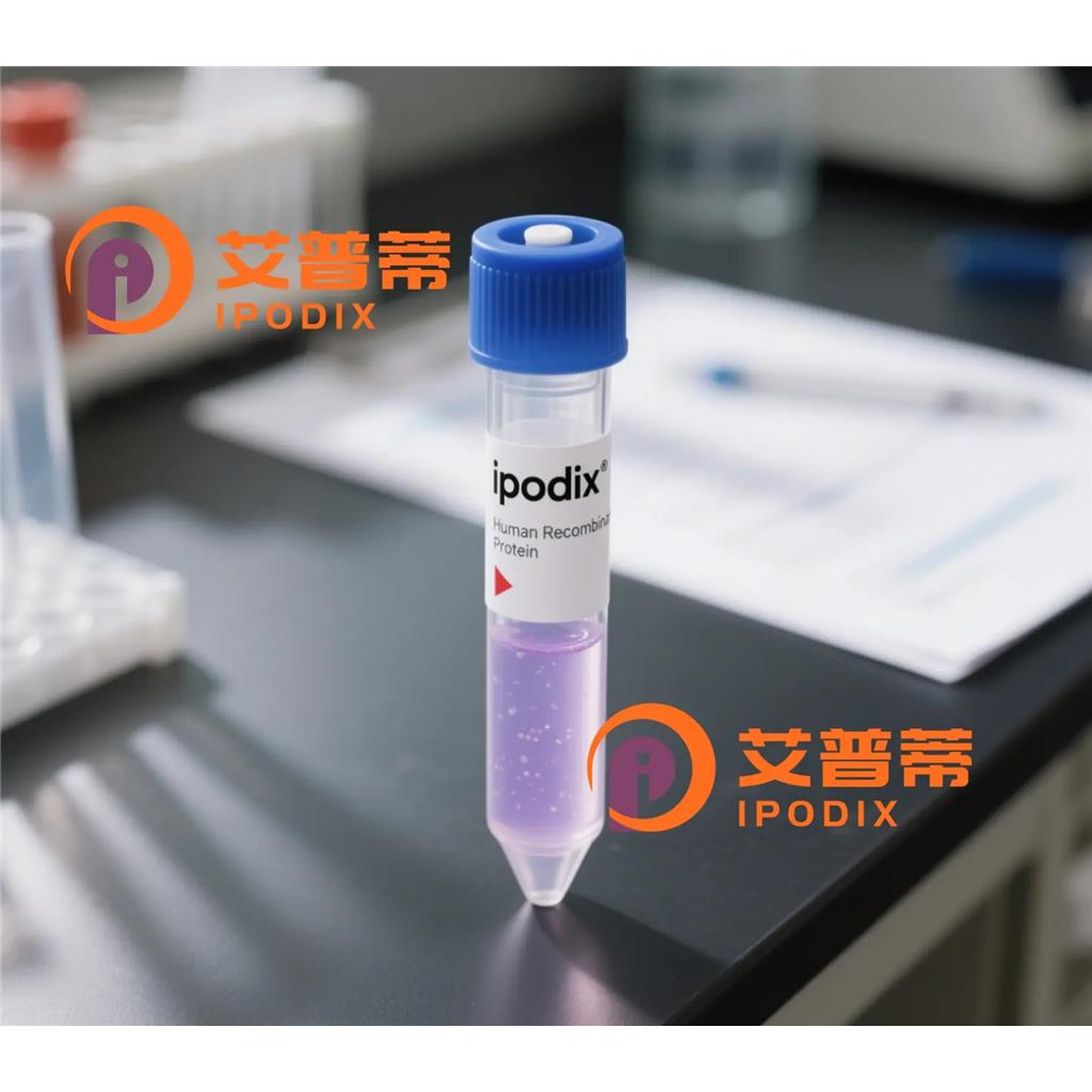 GEFH1抗体,Rabbit Monoclonal GEFH1 Antibody