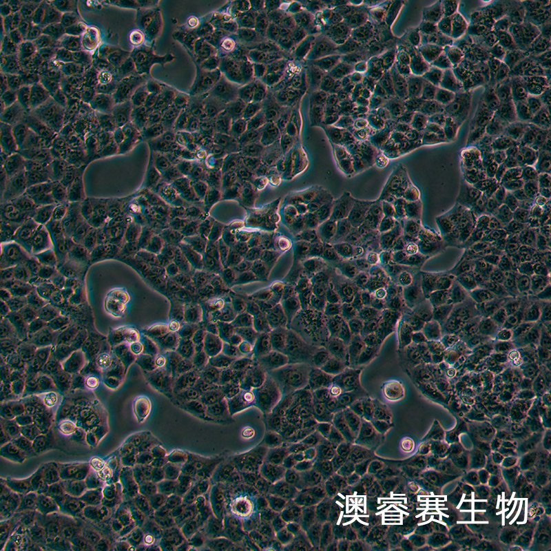 MKU74（人胃癌细胞）,MKU74