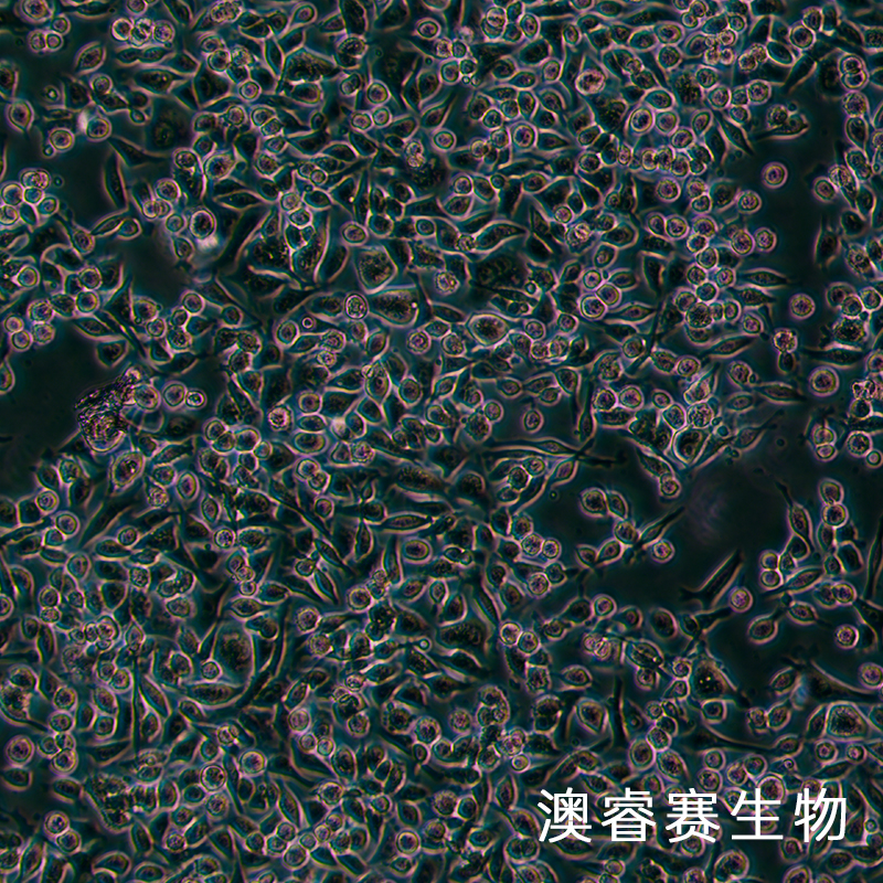 SNU601（人胃癌細胞）,SNU601